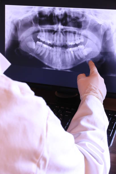 Best Emergency Dental Care for Sports Injuries in Pollock Pines, CA