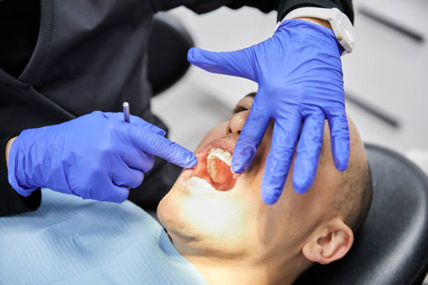 Best Knocked-Out Tooth (Avulsed Tooth) Treatment in Pollock Pines, CA